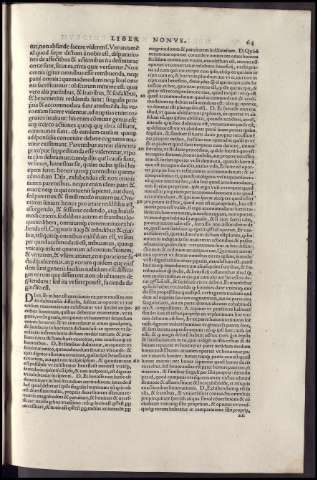 151
